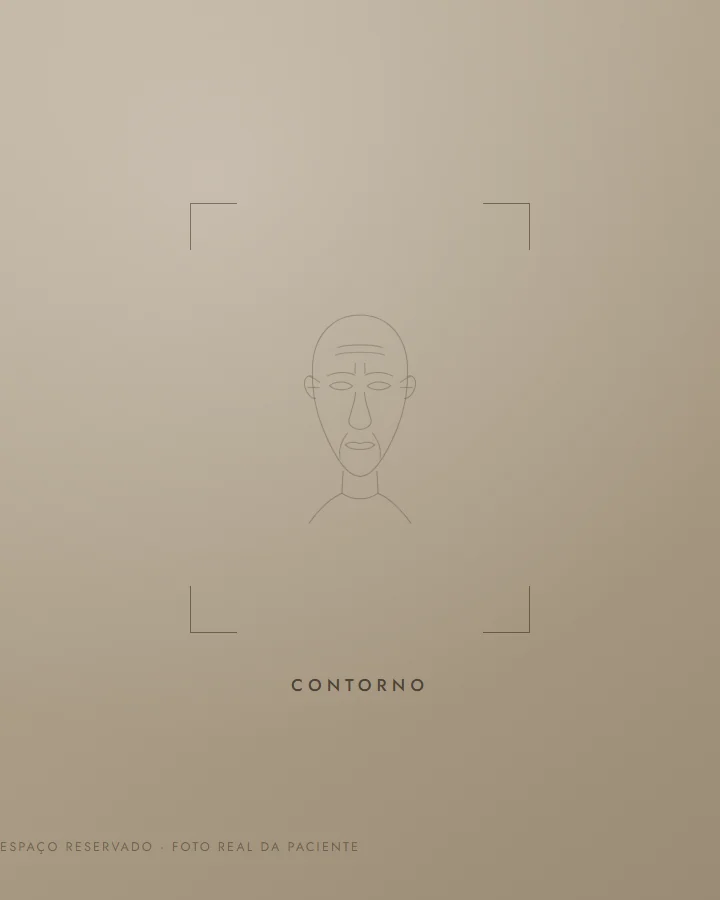 Contorno — antes (exemplo ilustrativo)